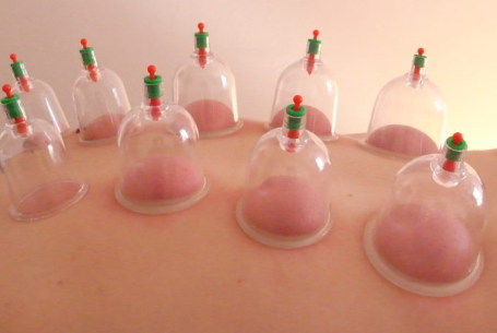 Cup Therapy 1
