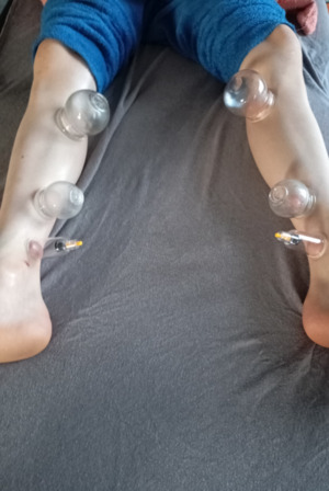 Cup Therapy 4