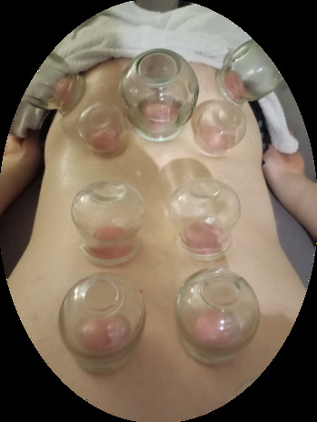 Cup Therapy 7